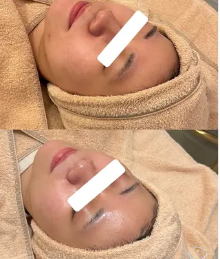 美容鍼サロンメゾンブランシェ所属・🌸美容鍼サロン🌸 メゾンブランシェ🌈のエステ・リラクイメージ