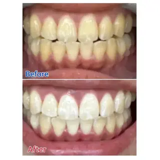 Ｍ渋谷 ホワイトニングのエステ・リラクイメージ