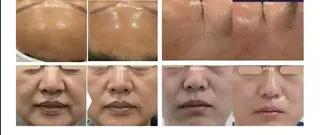 Monreve所属・美人スイッチdiet スーパージェクションのその他イメージ