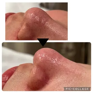 溝の口エステranan所属・化粧品成分研究/講師 ranan三浦のエステ・リラクイメージ