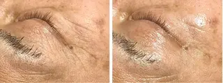 ビューティーサロン B.glossyのネイルデザイン