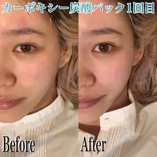 鍼灸 Refineのその他イメージ