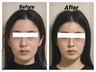 小顔矯正Sho  FaceDesignのエステ・リラクイメージ