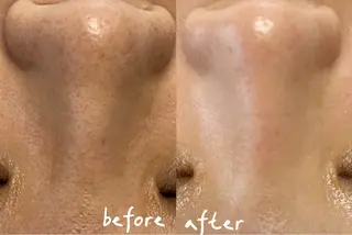 Nature Souce毛穴専門店のその他イメージ