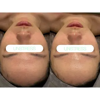 小顔コルギ ☆表参道/外苑前のエステ・リラクイメージ