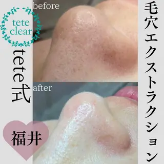 beauty salonWのエステ・リラクイメージ