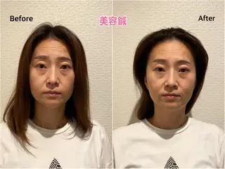 チキバン美容鍼灸整体 サロン心斎橋店のエステ・リラクイメージ