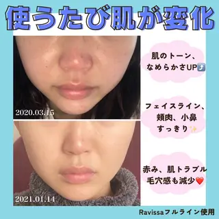 Prima 〜プリマ栄店〜のエステ・リラクイメージ