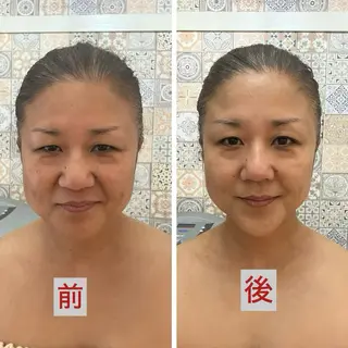 たるみ改善小顔エステ 堀葉月のその他イメージ
