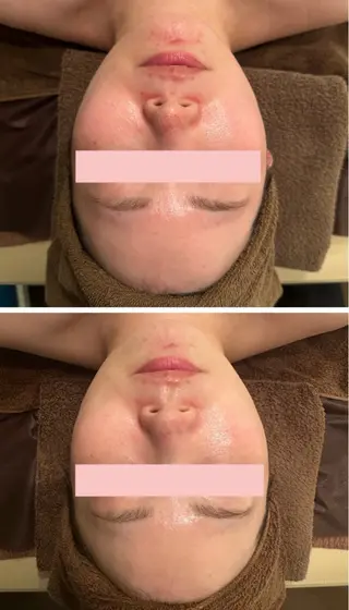 LaCachette ラカシェットのエステ・リラクイメージ