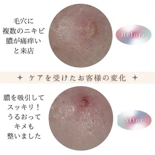 メンズ ネイル 浜松よもぎ蒸し/温活 /メナード認定サロンのエステ・リラクイメージ