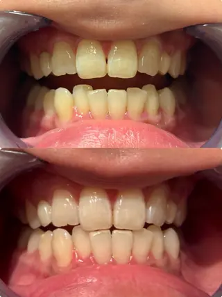 écrusmile ホワイトニングサロンのその他イメージ