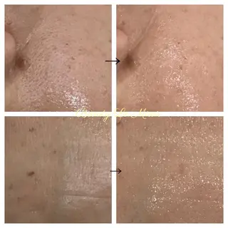 ビューティー ミロワールのエステ・リラクイメージ