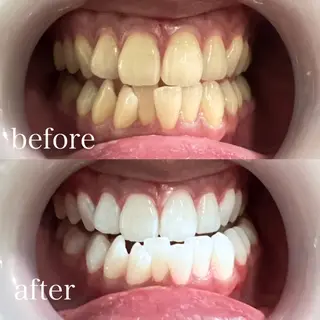 ホワイトニング×肌質 改善~elエル~のその他イメージ