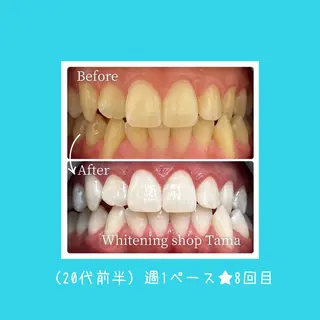 ホワイトニング ショップ多摩店のその他イメージ