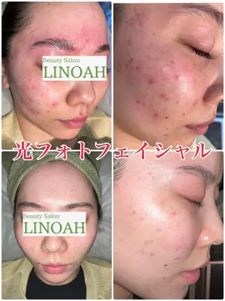 マツエク・マツパ アイブロウ メンズ ビューティーサロン リノアのエステ・リラクイメージ