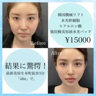 マツエク・マツパ aliaハーブ水光店 エステティシャン募集のエステ・リラクイメージ