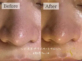 🌸🧡六本木 脱毛しずか🧡🫧の眉毛・アイブロウイメージ