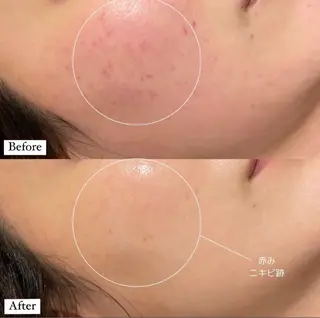 Queen Salonのエステ・リラクイメージ