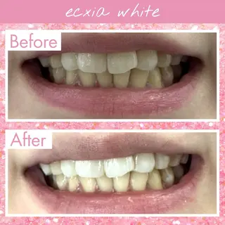 セルフホワイトニング エクシア戸田公園店のその他イメージ