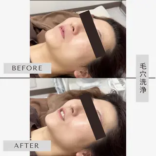 【小顔・毛穴ケア】 セラピスト　和田紋子のエステ・リラクイメージ