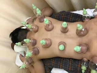 いとう 鍼灸整骨院のエステ・リラクイメージ