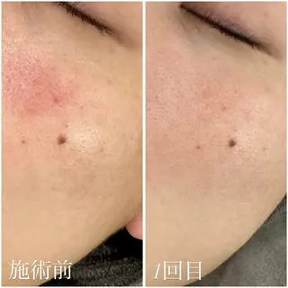 艶肌デトックス🫧 Samiraのエステ・リラクイメージ
