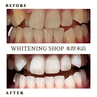 メンズ ホワイトニング ショップ本厚木のその他イメージ