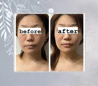 頭蓋骨小顔矯正 極眠ドライヘッド専門のエステ・リラクイメージ