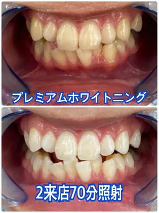 Platinum Beauty 四条烏丸店所属・吉田亮利 ホワイトニング専門店のその他イメージ