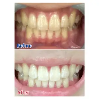 M渋谷 ホワイトニングのエステ・リラクイメージ