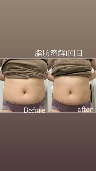 毛穴洗浄・痩身・脱毛 /アルカンジュのエステ・リラクイメージ