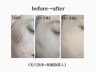 美肌脱毛/ワックス ALGO高槻店のエステ・リラクイメージ