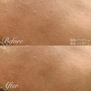 肌質改善ハーブサロン ALA原宿のエステ・リラクイメージ