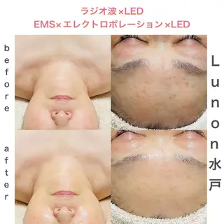 Lunon 【ルノン】のエステ・リラクイメージ