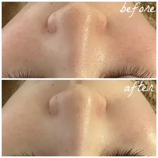 メンズ メナード岐阜茜部 杉浦のエステ・リラクイメージ