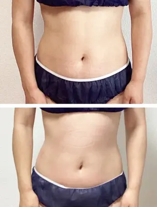 辻堂CHEART ボディ デザインのエステ・リラクイメージ