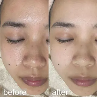 アイブロウ&フェイシャルサロンa‘lm所属・WAX脱毛/肌質改善 眉毛とお肌のサロンのエステ・リラクイメージ