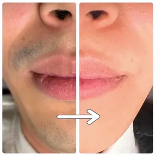 メンズ メンズ脱毛サロン Le falcoのエステ・リラクイメージ