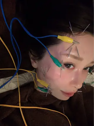 圧倒的たるみ改善 美容鍼エステのエステ・リラクイメージ