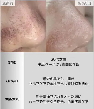 脱毛・眉毛・フェイス サロンN久留米店の眉毛・アイブロウイメージ