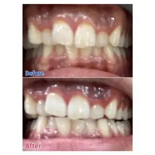 Ｍ渋谷 ホワイトニングのエステ・リラクイメージ