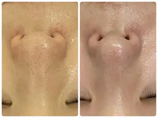 Salon Rion所属・Rion 野々村のエステ・リラクイメージ