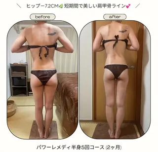 《本気痩せ×疲労改善 》  BILOOPのエステ・リラクイメージ