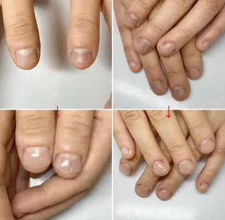 ネイル ネイルサロン アリュームのネイルデザイン