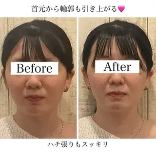 小顔矯正 natsuのエステ・リラクイメージ