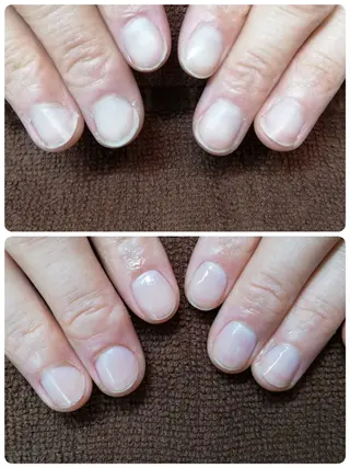 ネイル 深爪矯正/爪育成ケア manie nailのネイルデザイン