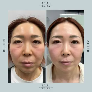 ULUS mamiのマツエク・マツパデザイン