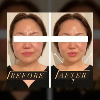 Lam..肌質改善 専門 女性専用サロンのエステ・リラクイメージ