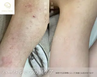 脱毛・眉毛・フェイス サロンN久留米店の眉毛・アイブロウイメージ